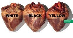 Oliviero-Toscani-Heart