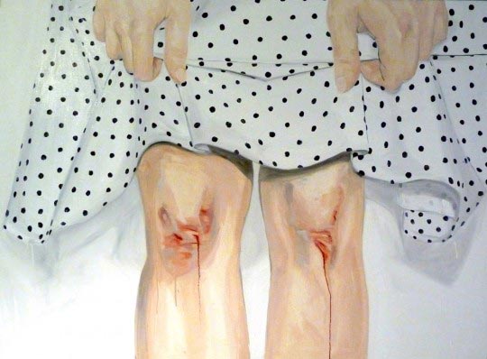 Julien Legars, The skinned knees, 2011, 130x97cm