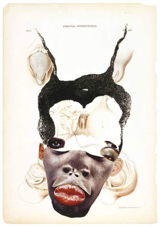 Wangechi Mutu, Cervical hypertrophy