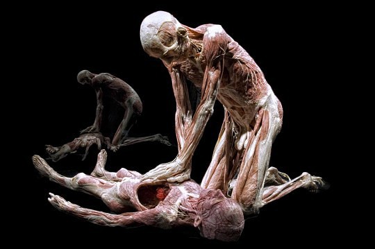 Gunther von Hagens