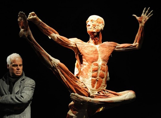 Gunther von Hagens