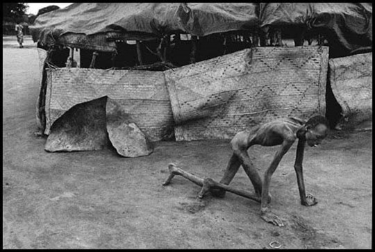 James Nachtwey, Sudan, 1993 - Famine victim in a feeding center